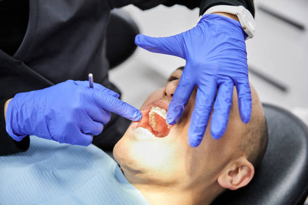 Best Weekend Emergency Dental Services in San Rafael, CA