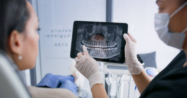 Best Broken or Chipped Tooth Repair in San Rafael, CA