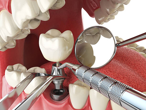Best Weekend Emergency Dental Services in San Rafael, CA
